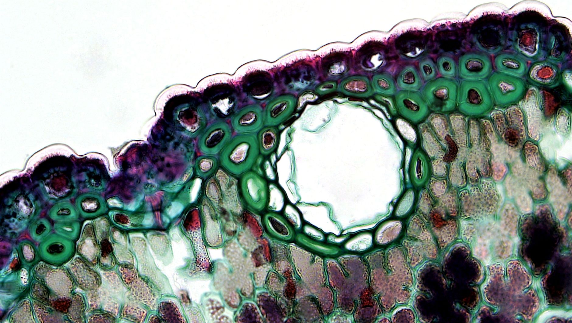 cell seen under microscope